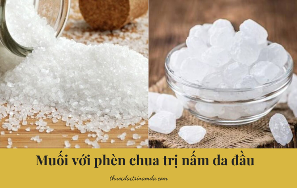 muoi voi phen chua tri nam da dau